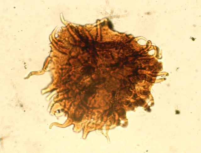 Une autre spore des assemblages palynologiques de la Formation d’Escuminac